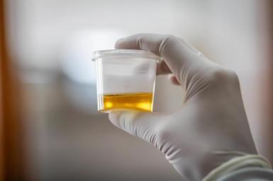 urologist-urine-sample.jpg